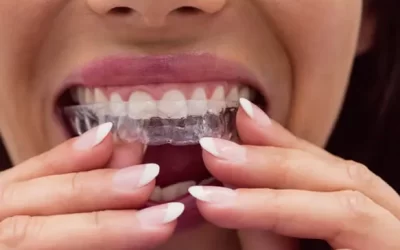 Invisalign Reno: Clear Aligner Therapy for Discreet Orthodontic Correction